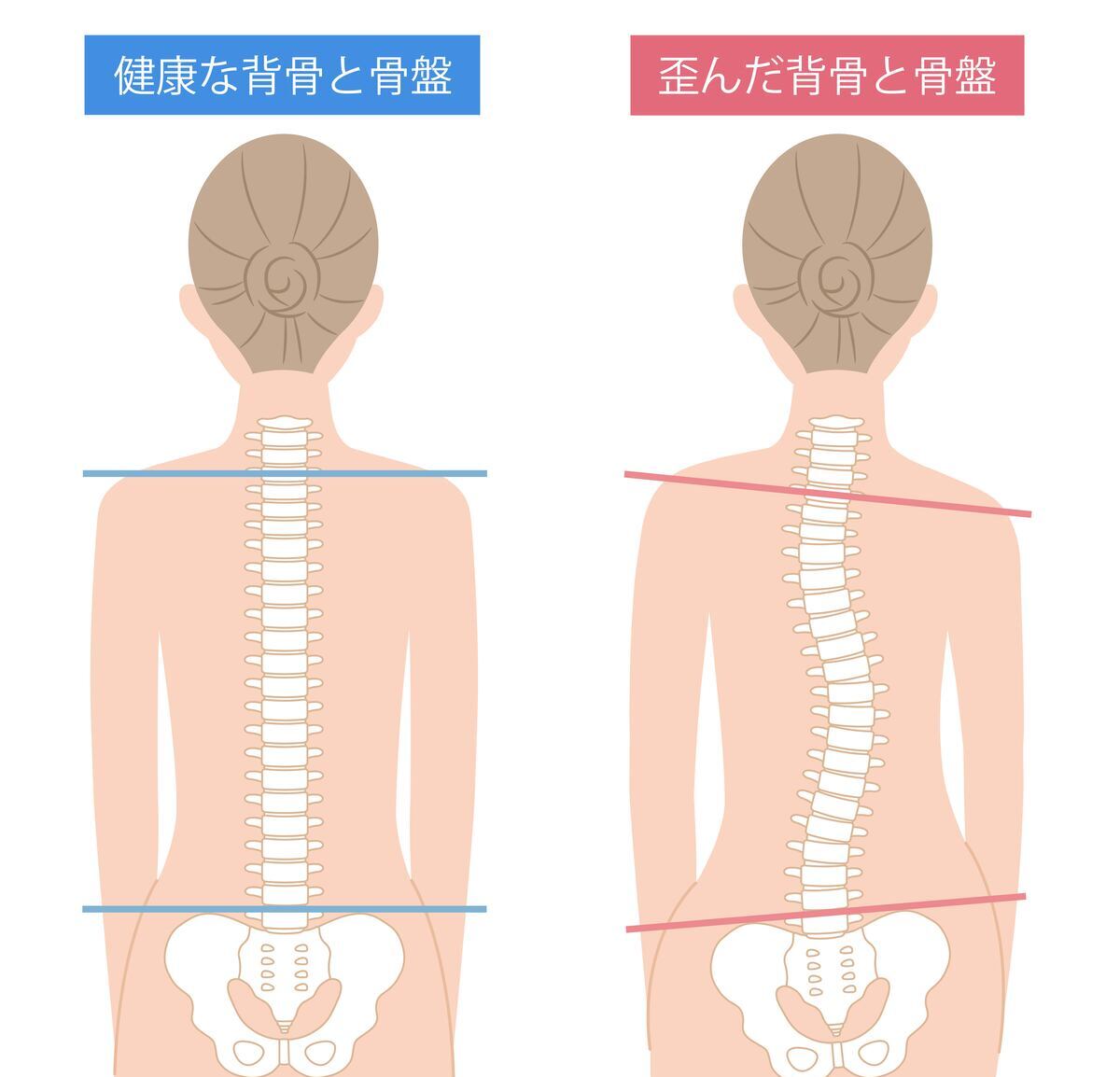 整体で背骨を整え自己回復力を促すDRTのイメージ図
