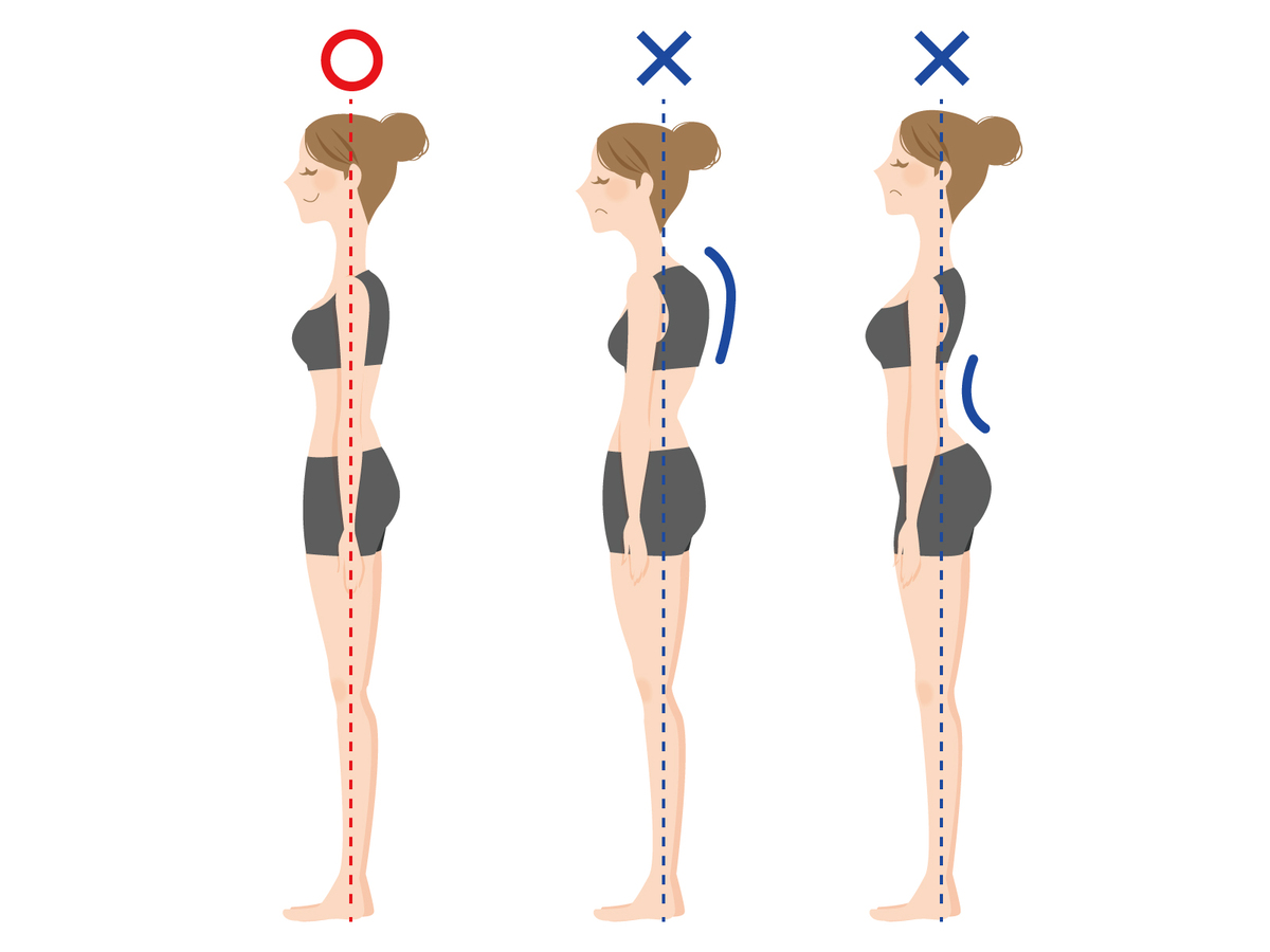 正常、猫背、反り腰の姿勢