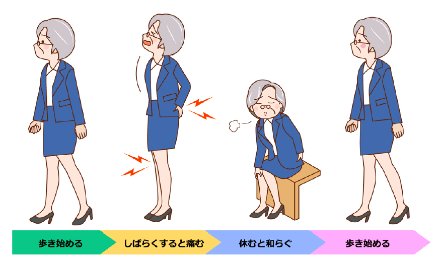 間欠性跛行